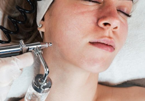 oxygen facial